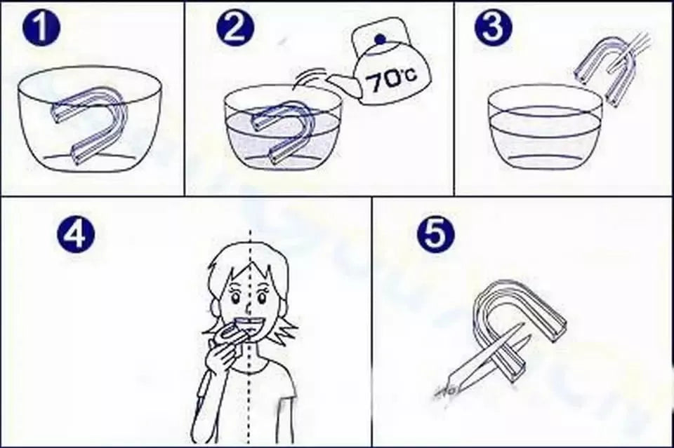 😁Placa Anti bruxismo y Ronquidos😴