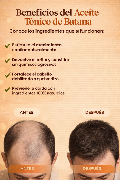 ✨Aceite De Batana + Romero - Crecimiento y Salud Del Cabello 🌿 (30ml)