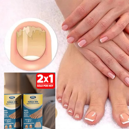 🦶 Parches Antihongos para Uñas – Recupera Uñas Sanas y Limpias✨